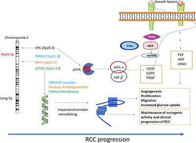 Precision Medicine: An Optimal Approach to Patient Care in Renal Cell Carcinoma